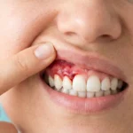 Gum specialist Dubai: Your Guide to Expert Periodontal Care in UAE