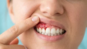 gum specialist dubai
