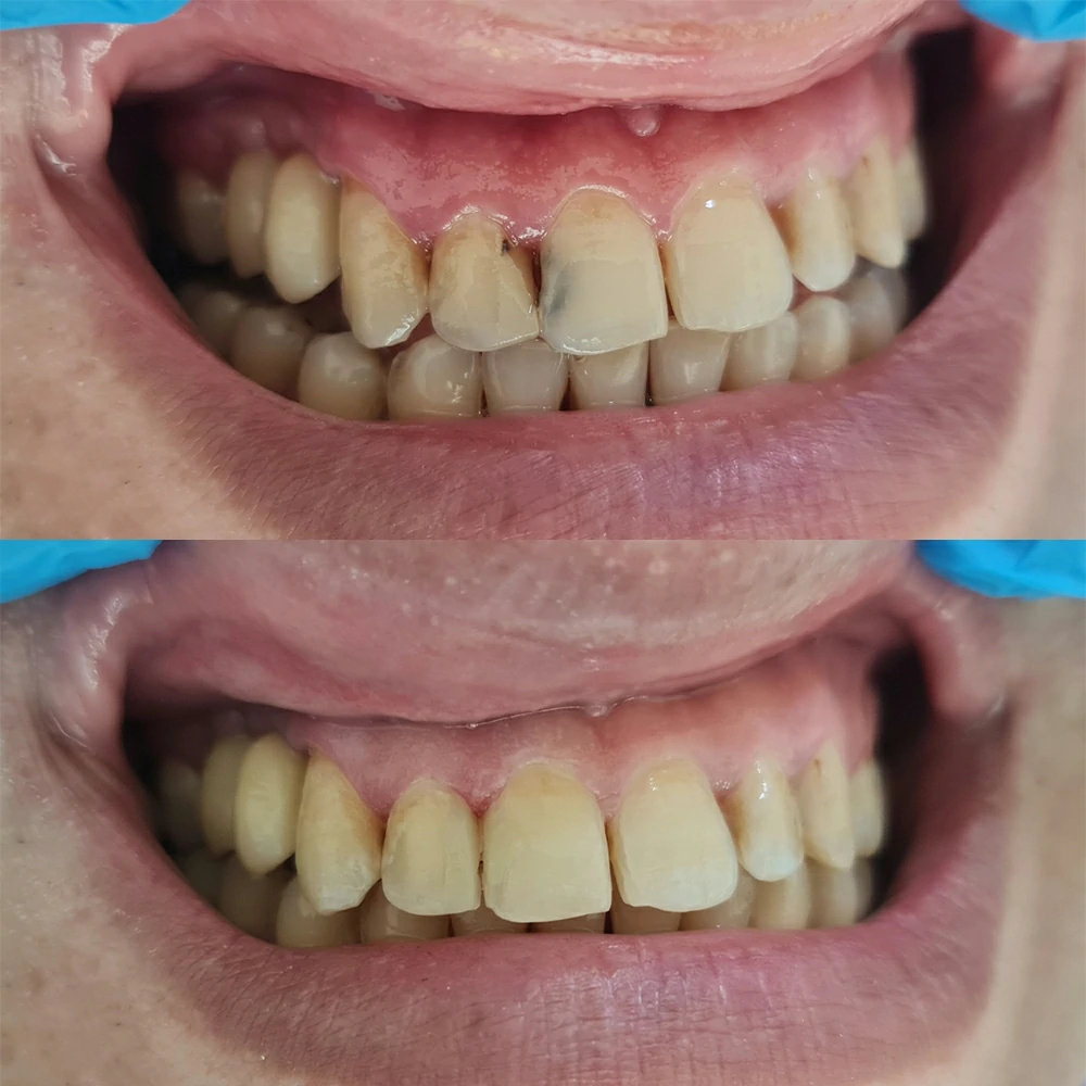 Shape Correction