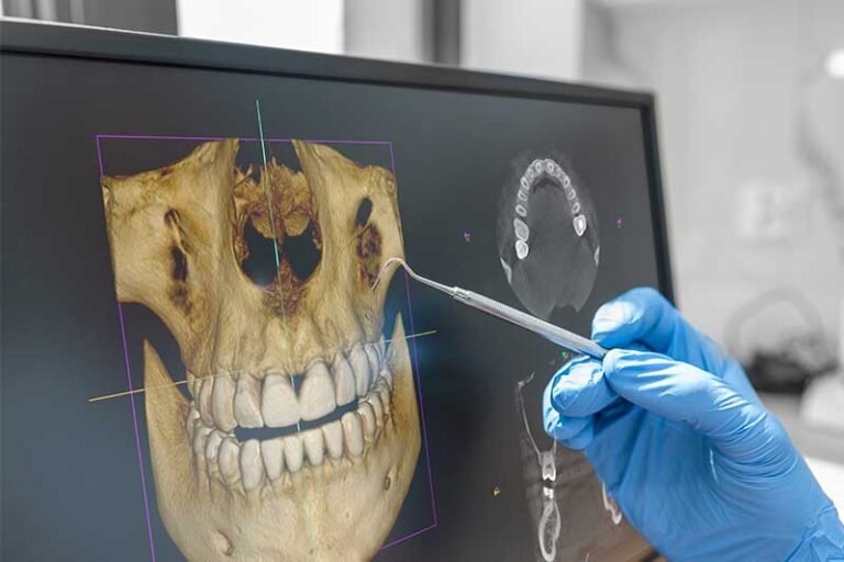 Dental imaging technology for treatment planning