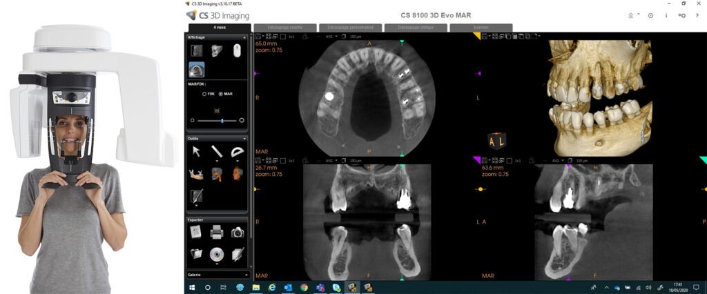 3D Imaging