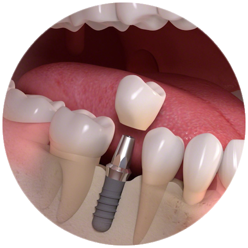 cbct planning image