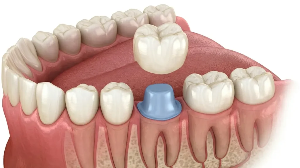 Restorative Dentistry