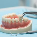 Dental crown before and after: Your Ultimate Guide to a Transformed Smile
