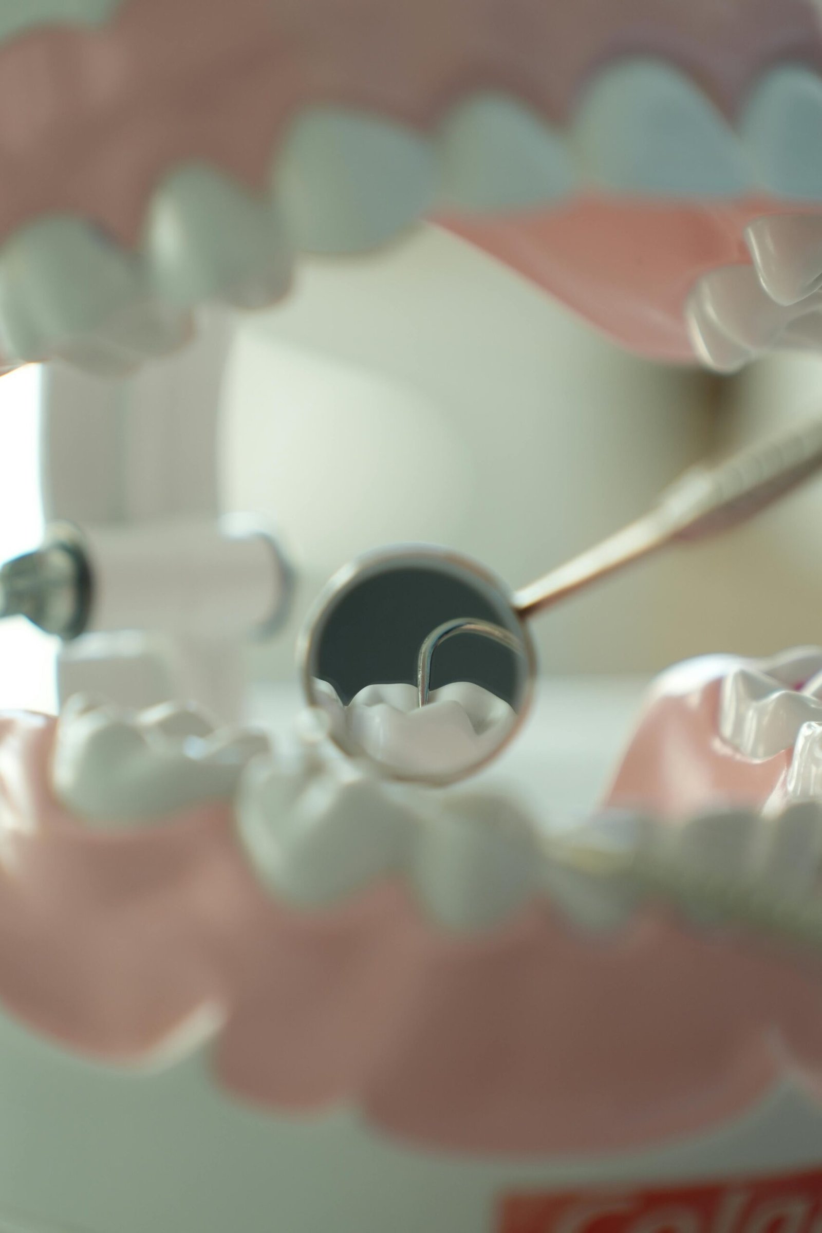 Smile Makeover
