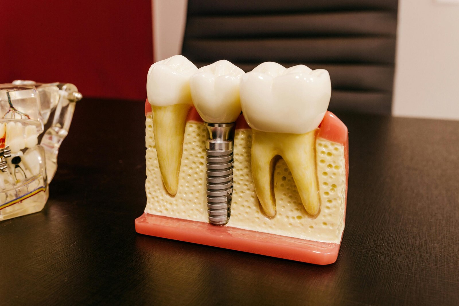 Zoom Teeth Whitening