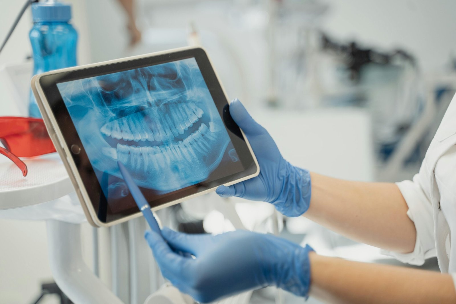 Porcelain Veneers