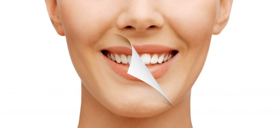 Digital dental implant and restorative treatment planning
