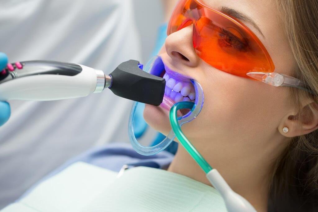 Best teeth whitening Dubai