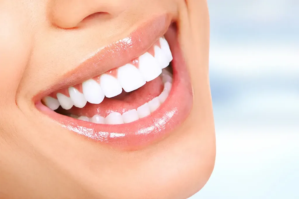 Personalised Smile Makeover treatment result