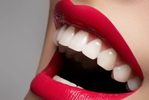 Hollywood smile consultation