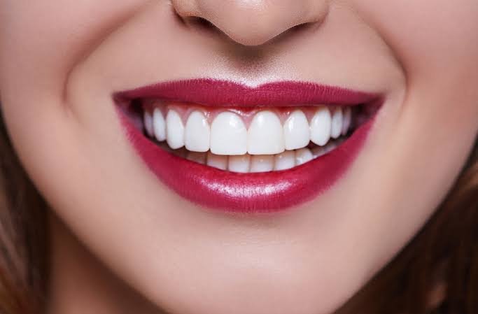 Smile makeover consultation