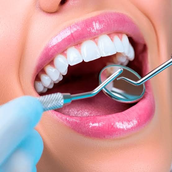 Zygomatic implant surgical procedure