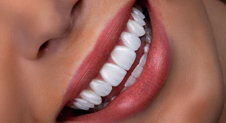 Hollywood Smile shade selection and final planning