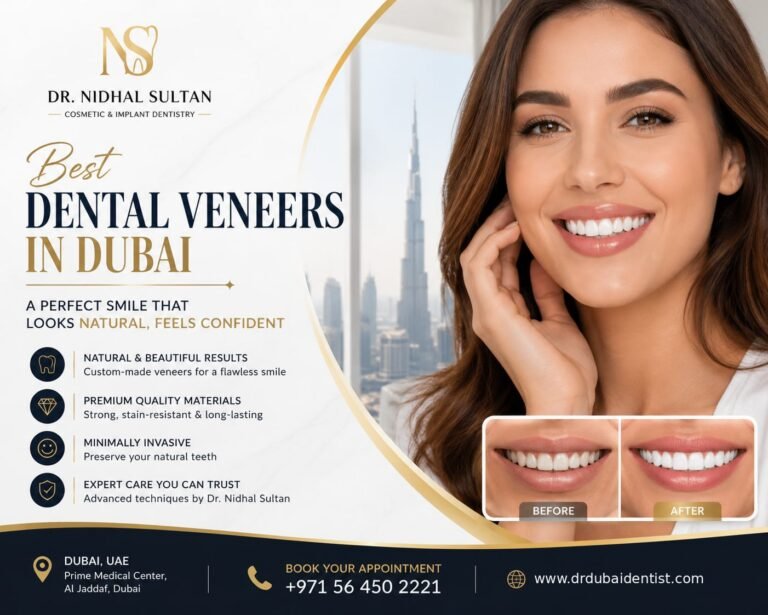 Best dental veneers in Dubai: Cost, Types & 2026 Guide | Complete