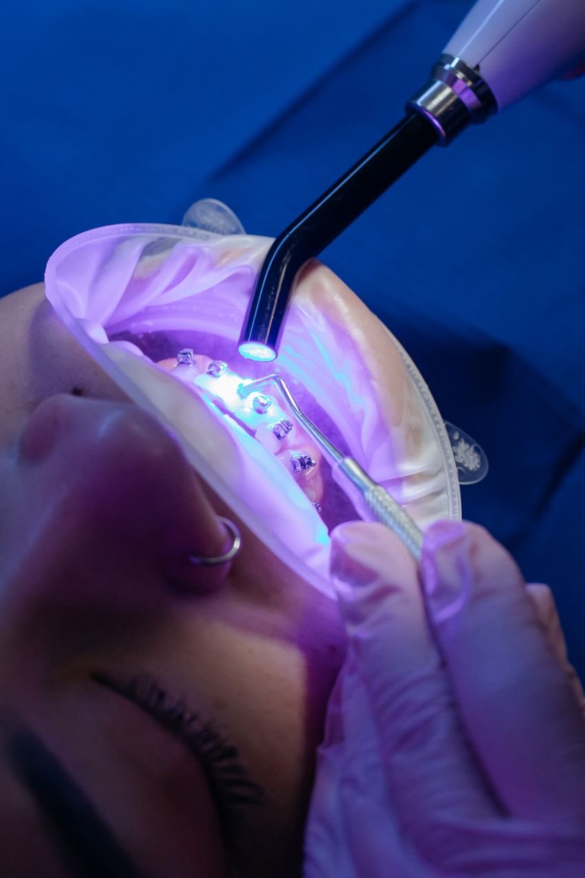 Treatment Plan — illustrative orthodontic image