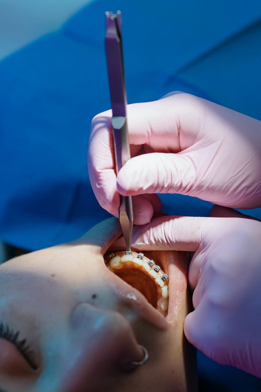 Active Treatment — illustrative orthodontic image